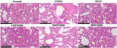 Investigation of the therapeutic effects and mechanisms of Houpo Mahuang Decoction on a mouse model of chronic obstructive pulmonary disease